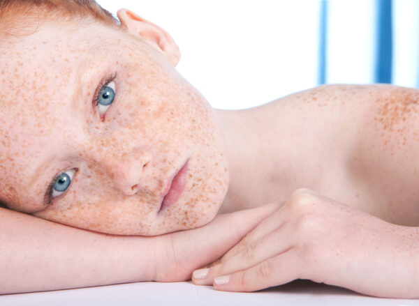 Dermatología Pediátrica