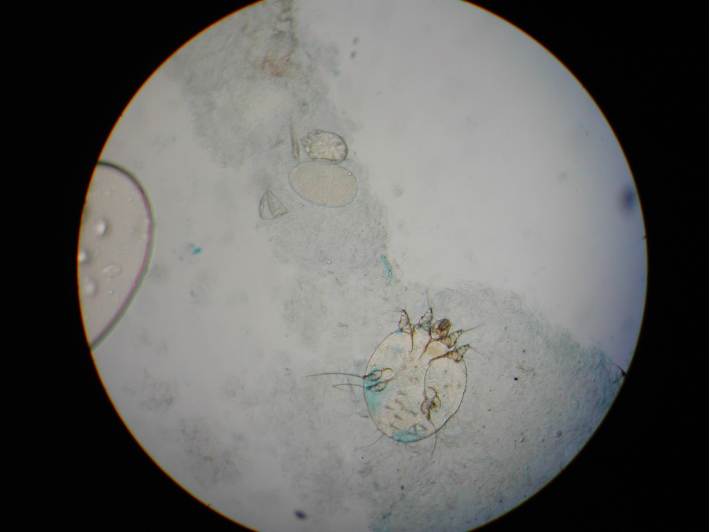 Ácaro de la sarna visto al microscopio Ácaro de la sarna visto al microscopio