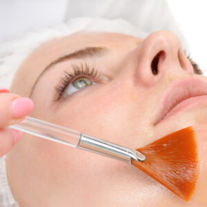 Facial peeling