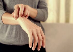 Dermatitis Atópica