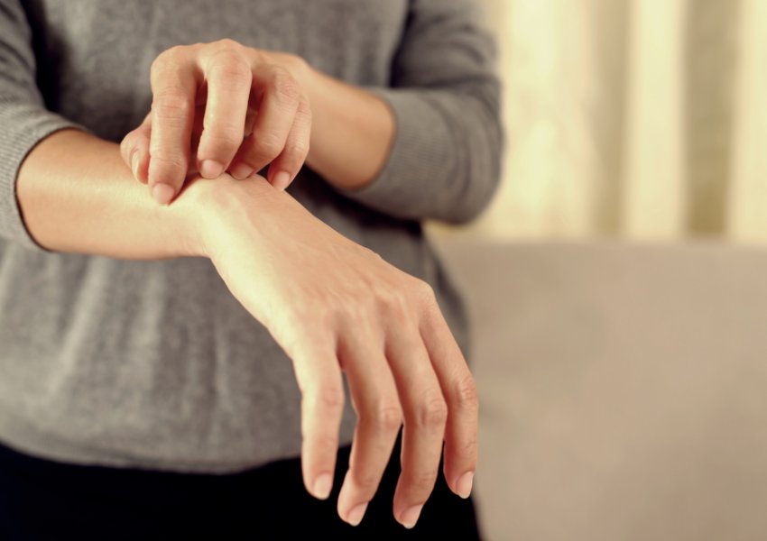 Dermatitis Atópica