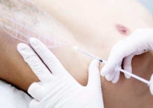 Hiperhidrosis exceso sudoración