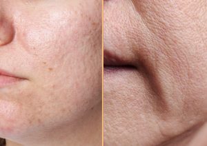 Dermatología integrativa