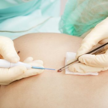 DERMATOLOGÍA QUIRÚRGICA