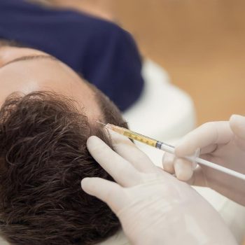 MESOTERAPIA CAPILAR