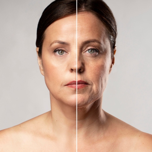 REJUVENECIMIENTO FACIAL SERVICIO DERMATOLOGIA TUDERMA