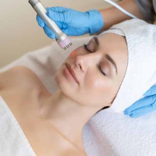 laser dermatologico tuderma